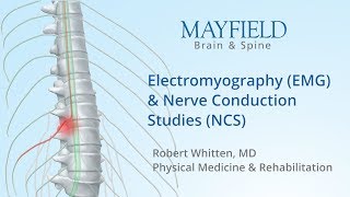 Electromyography EMG amp Nerve conduction studies NCS [upl. by Aremihc]