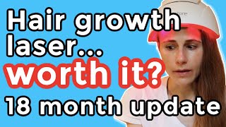 iRestore hair growth laser 18 month update Is it worth it Dr Dray [upl. by Annahsirhc]