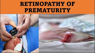 What Causes ROP  Retinopathy of prematurity [upl. by Nylodnarb]