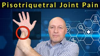 Pisotriquetral Wrist Joint Pain  Advice Self Help and Treatment [upl. by Rehpotsirk]