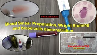 Blood Smear Preparation Wright Staining and blood cells demonstration [upl. by Smitty718]