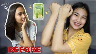 GLUTA MELONY 1 WEEK REVIEW  Gluta Melony Honest Review [upl. by Limaa]