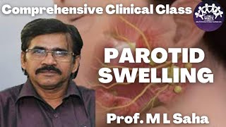 Parotid Swelling  Clinical Case Presentation [upl. by Ennazzus]