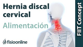 Hernia discal cervical derecha Alimentación nutrición y modificaciones en la dieta [upl. by Imerej]