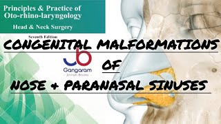 Congenital Malformations of the Nose and Paranasal Sinuses PART1 [upl. by Merlina]