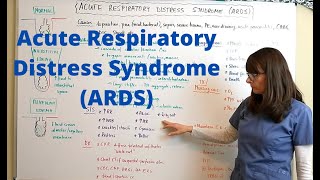 Acute Respiratory Distress Syndrome ARDS [upl. by Sitto]