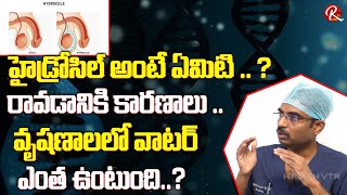 What is Hydrocele  How much water is in the testicles  Dr P Vamsi Krishna  RTV Health [upl. by Aninaj]