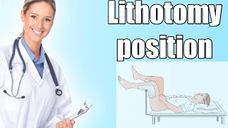 Lithotomy position indications  Physiological effects  Hazards [upl. by Elleira]