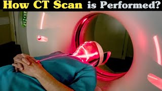 What is CT Scan  How CT Scan Is Performed UrduHindi [upl. by Dominik]