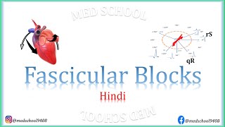 Fascicular Blocks Hindi [upl. by Danette470]