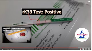 rk39 test Positive Visceral LeishmaniasisKalazar [upl. by Yv]