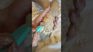 Full foot callus removal  Epidermolytic Palmoplantar Keratoderma  Jan 30 2023 [upl. by Elberta]