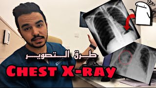 شرح كامل لوضعيات Chest Xray 🫁 [upl. by Orrin]