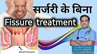 Fissure ki dawai  Fissure treatment  Fissure symptoms and cure  Fissure treatment in hindi [upl. by Sherfield695]