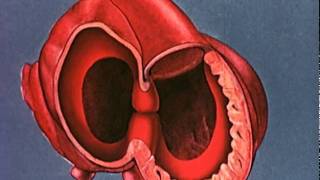 Congestive Heart Failure Pathophysiology [upl. by Nileak]