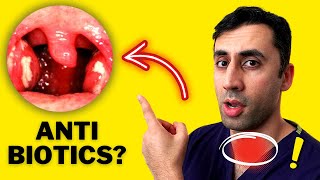 Sore throat TREATMENT Do antibiotics work on all sore throats  Doctor Explains [upl. by Adel781]