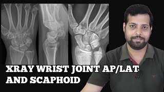 HOW TO DO WRIST JOINT AP LAT SCAPHOID SERIES xrayclasses WRISTJOINT xraytechnician [upl. by Inafets]