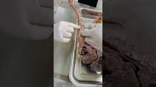 Real spinal cord experience lab 🔬 viralvideo medicalstudents nursing mbbs neet [upl. by Anatnom556]