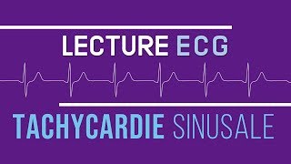 Interprétation ECG  Tachycardie Sinusale [upl. by Eek197]