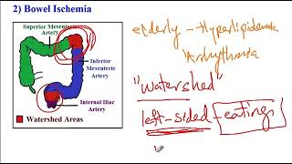 USMLE ACE Video 158 Lower Gastrointestinal Disorders [upl. by Ettenej]