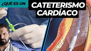 CATERISMO cardiaco y STENT 💉 RIESGOS e indicaciones ✅ [upl. by Morell]