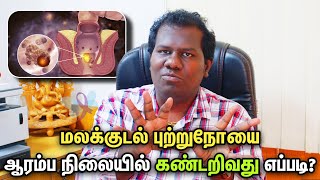 How to Find Rectal Cancer in Early Stageமலக்குடல் புற்றுநோயை ஆரம்ப நிலையில் கண்டறிவது எப்படி Tamil [upl. by Glovsky]