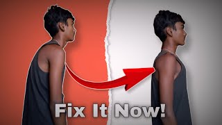 How to Fix Your Posture No BS Guide [upl. by Claudette]