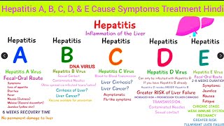 Complete Hepatitis  Hepatitis A B C D amp E Cause Symptoms Diagnosis Treatment Hindi Hepatitis [upl. by Dibbell]