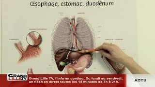 Santé le reflux gastrique cest quoi [upl. by Dnartreb14]