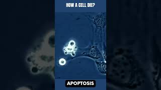 Cell death under the microscope apoptosis [upl. by Eidas]