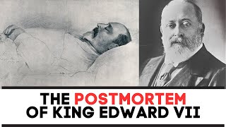 The POST MORTEM Of King Edward Vii [upl. by Kcirdneh267]