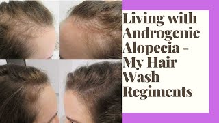 Living with Androgenic Alopecia  My Hair Wash Regimens [upl. by Emery975]