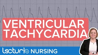 Ventricular Tachycardia ECG Interpretation amp Presentation [upl. by Lehcnom]