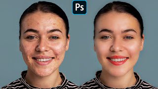 Face Retouching  Best Photoshop Tutorial  Skin Retouching [upl. by Shepard491]