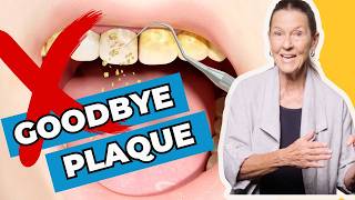 Eliminate Plaque with These Simple Tips [upl. by Aicnelav]