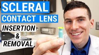 How to Insert and Remove SCLERAL LENSES  Beginners Guide to Scleral Lenses [upl. by Quincy451]