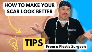 Tips for Treating Scars [upl. by River]