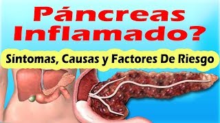 SINTOMAS DE PANCREATITIS AGUDA Y CRONICA Sintomas Del Pancreas Inflamado y Sus Causas [upl. by Kathlin]