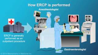 Understanding ERCP Endoscopic Retrograde Cholangiopancreatography [upl. by Elletnuahs]