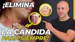 ¡ATENCIÓN GUÍA COMPLETA PARA ENTENDER Y ELIMINAR LA CÁNDIDA DE TU CUERPO  SIGNOS DE CÁNDIDA [upl. by Ahsatan308]