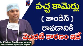 Jaundice  పచ్చ కామెర్లు  Causes Symptoms and Treatment in Teluguజాండిస్ లక్షణాలు పరిష్కారం [upl. by Terza]