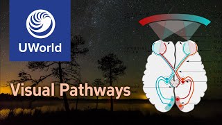 Visual PathwaysOptic Nerve PathwayVision  USMLE Step 1 UWorld Questions MBBS Ophthalmology [upl. by Aicemak210]