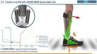 EN The Right Orthosis in case of a Combined Weakness of the Dorsiflexors and Plantar Flexors 34 [upl. by Remo]