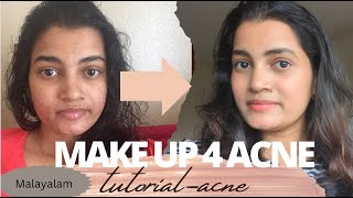 Acne prone skin makeup Make up for skin with pores in malayalam [upl. by Alys]