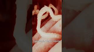 Tapeworm in Human Intestine  Taenia sp  Flat worms  Endoparasites  Phylum Platyhelminthes [upl. by Fugazy]