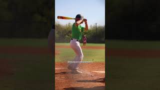 Middle school madness photo dump￼ baseball music fun photo [upl. by Eckblad]