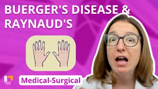 Buergers Disease and Raynauds  MedicalSurgical  Cardiovascular System  LevelUpRN [upl. by Rossner]