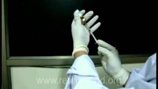 INTRAVITREAL INJECTION PREPARATION [upl. by Oirifrop]