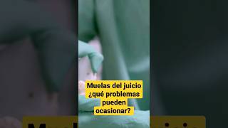 Causas por las que duelen las muelas del juicio 🦷odontologia dientes muelasdeljuicio muela [upl. by Acemaj]