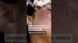 Mesotherapy for Skin Repair [upl. by Eimerej]